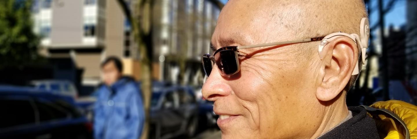 A patient with their profile to the camera shows their cochlear implant